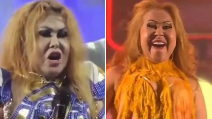 Diagnóstico da cantora Joelma explica inchaço no rosto